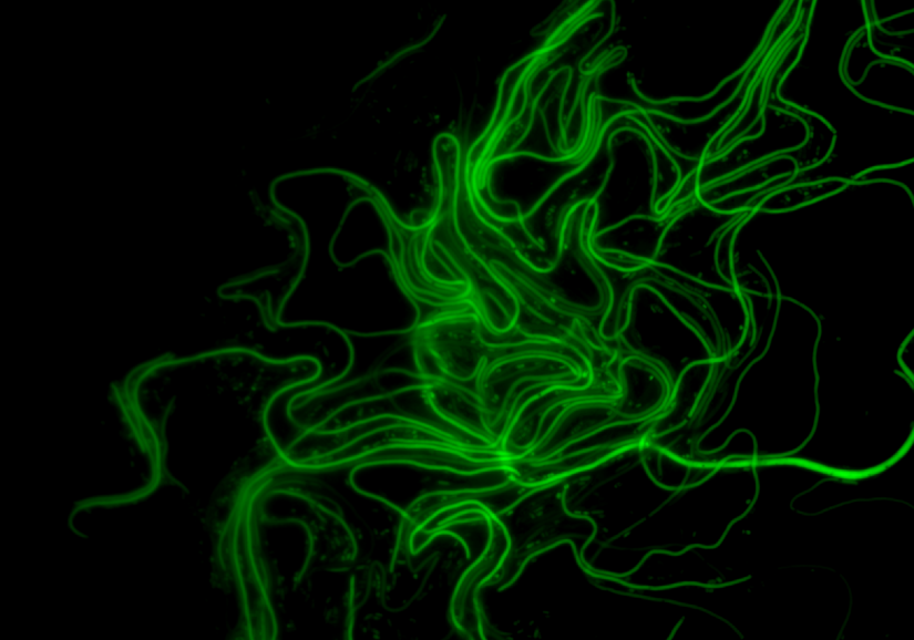 Uropathogenic E. coli filaments expressing Green Fluorescent Protein (GFP) after exfoliation from bladder cells, captured using epi fluorescence microscopy. 
