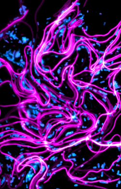 Image of UTI bacteria trails in magenta and blue