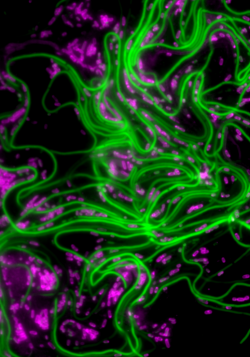 Imaging of UTI bacteria in green and purple