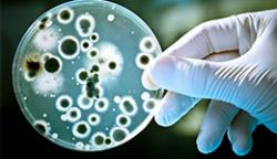 A gloved hand holding a petri dish containing harmful bacteria