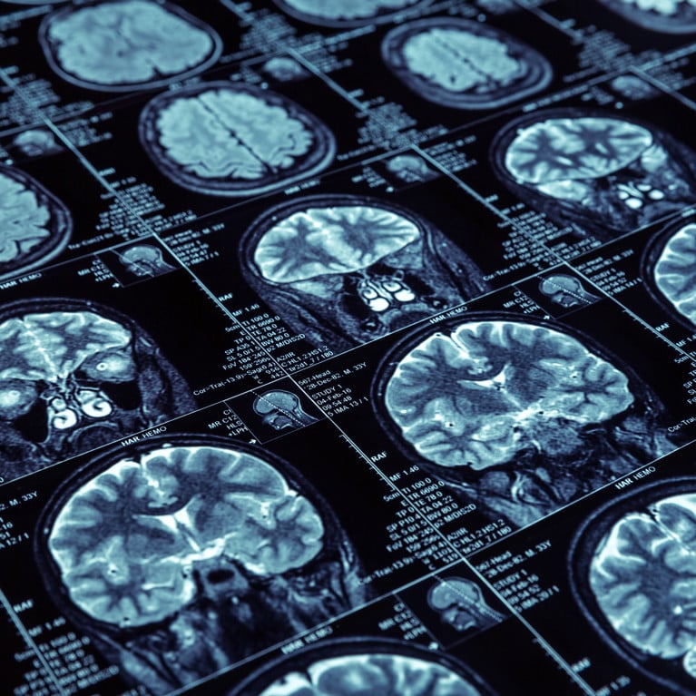 Multiple MRI scans showing cross-sectional images of the human brain.