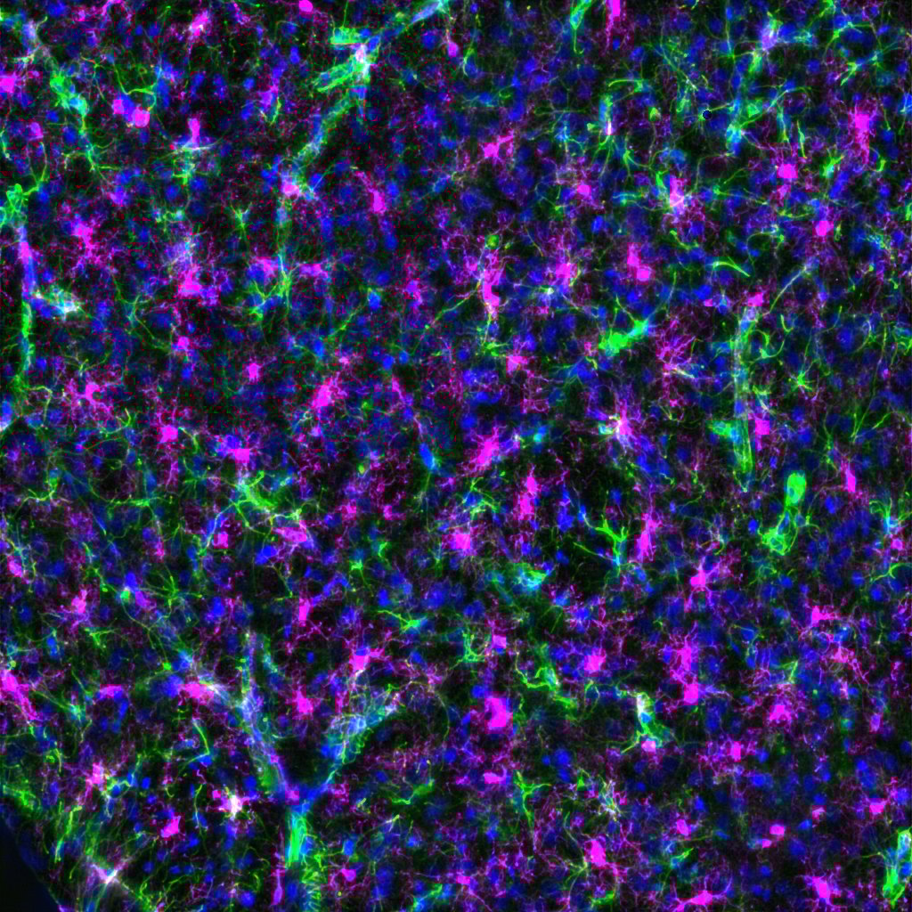 Microscopic image of neural tissue stained with fluorescent dyes. Bright green and pink cell structures branch across a dark background, creating a vibrant, intricate pattern.