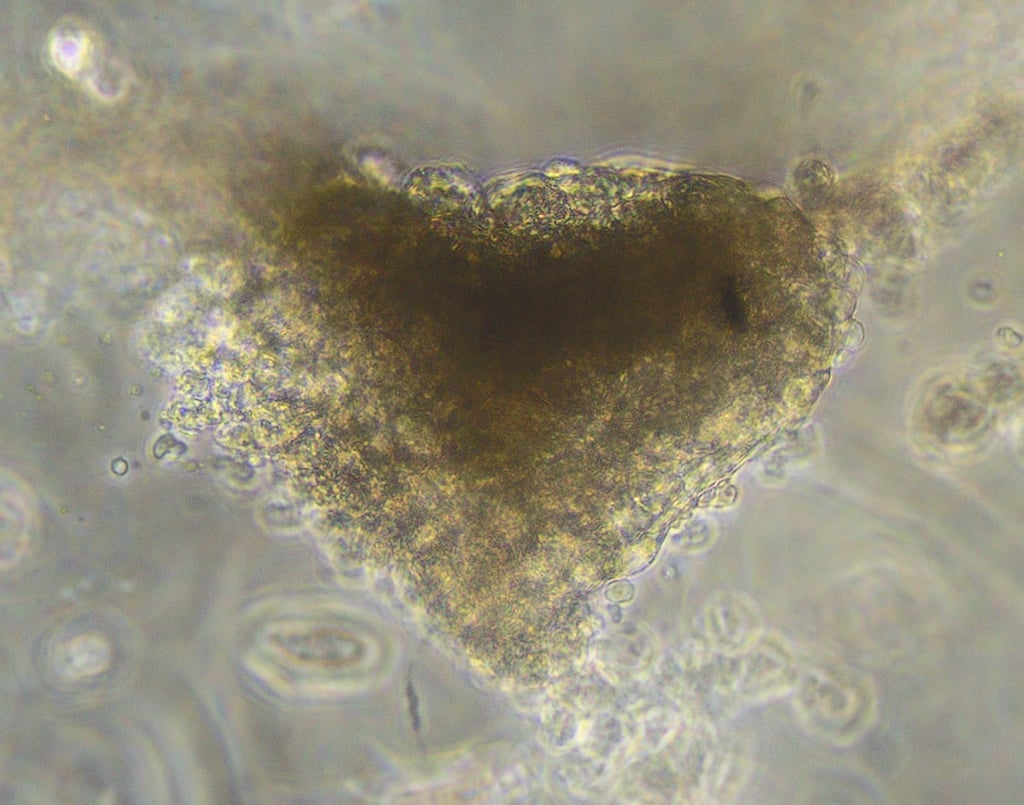A microscopic view of a mini heart made of stem cells