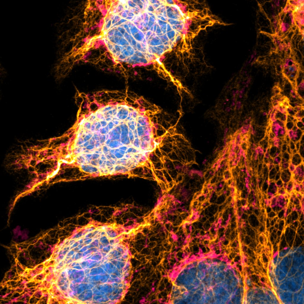 Microscopic image of trophoblast cells treated with TNFα to induce inflammation.
