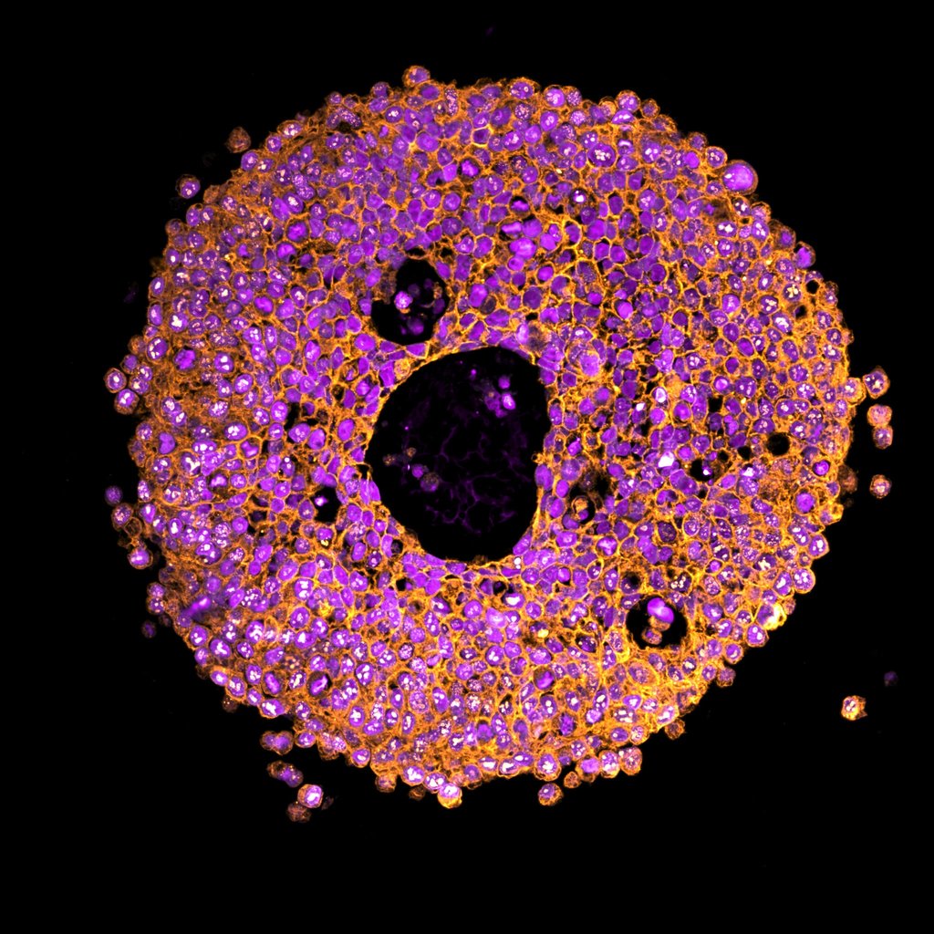 Colourful microscopic image of a cell featuring a dark centre surrounded by an intricate network of glowing orange and purple structures on a black background.