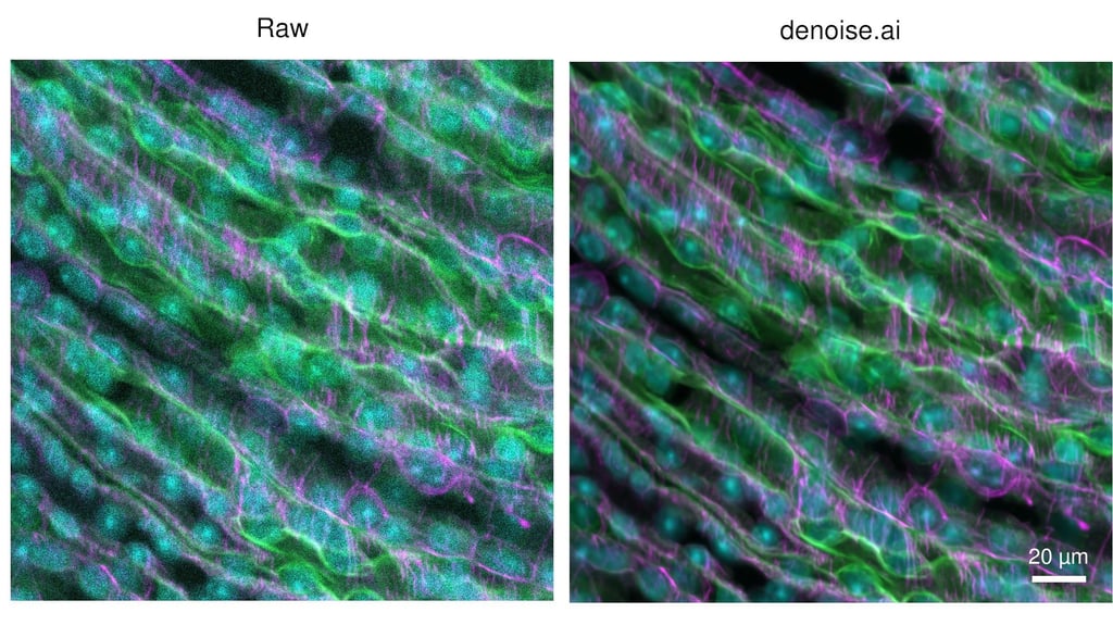 Nikon A1R image processsed with denoise