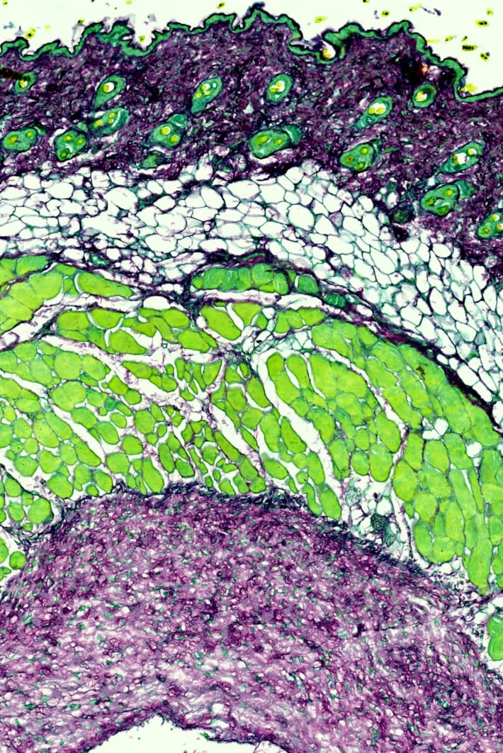 Collagen in colour