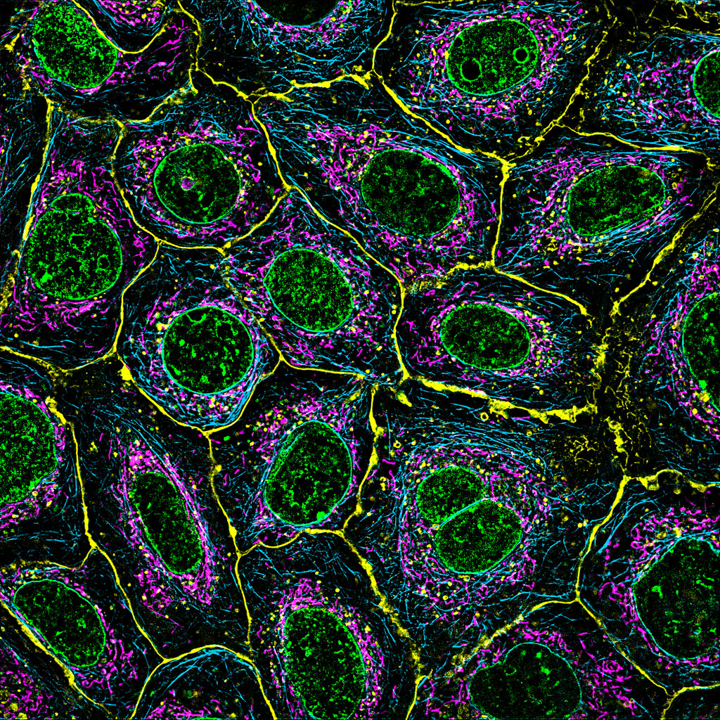 Fluorescent microscopy image showing red and green-stained cells against a black background. The split-screen displays identical high-contrast cellular patterns.