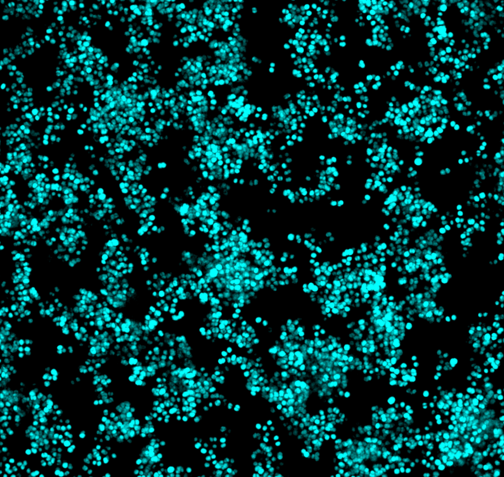 Fluorescent visualisation of Staphylococcus aureus SH1000-GFP microcolony formation