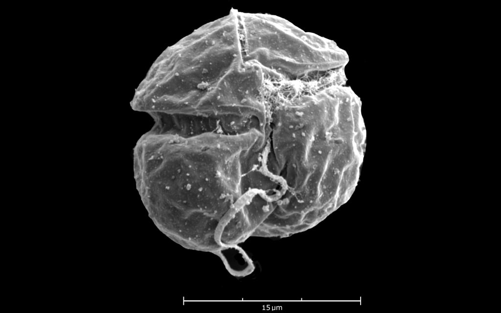 A scanning electron microscope image of K. cristata