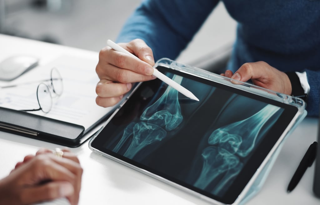 Close-up of a doctor's hands holding a tablet with a knee x-ray on the screen.