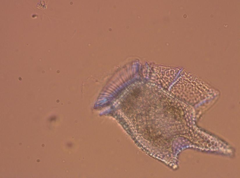 phytoplankton dinophysis