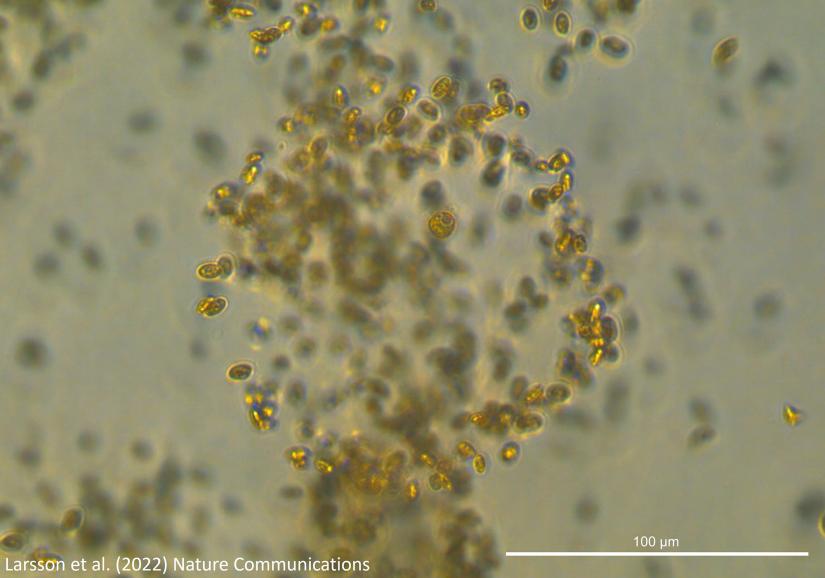 The mixotrophic protist Prorocentrum cf. balticum observed within its “mucosphere”, laden with captured prey cells.