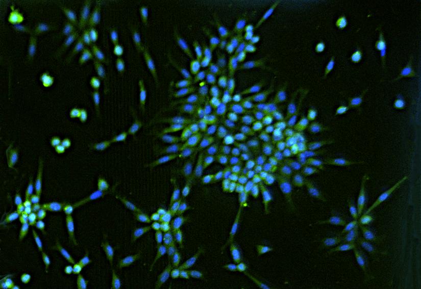 An image of cells on a disc-on-a-chip modelling a healthy intervertebral disc, researcher provided