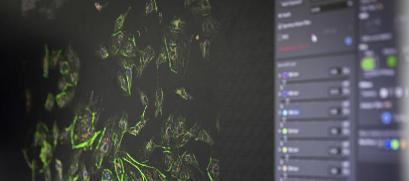 Image from microscope