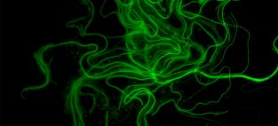 Microscope imaging of bacterial filaments 