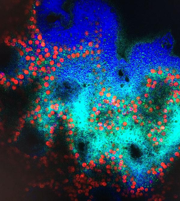 Chlorophyll fluorescence imaging of endosymbiotic dinoflagellates (in red) within coral tissues