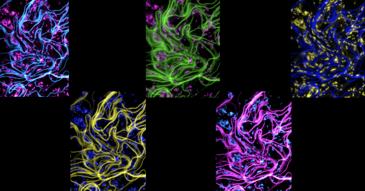 Collage of UPEC filaments and rods after a model Urinary Tract Infection. Pseudocoloured for visual effect. 