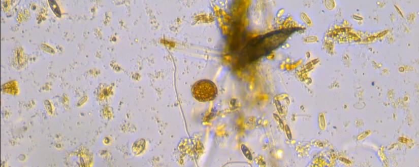 Microscopic Algae
