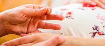 Pregnant women uses acupuncture