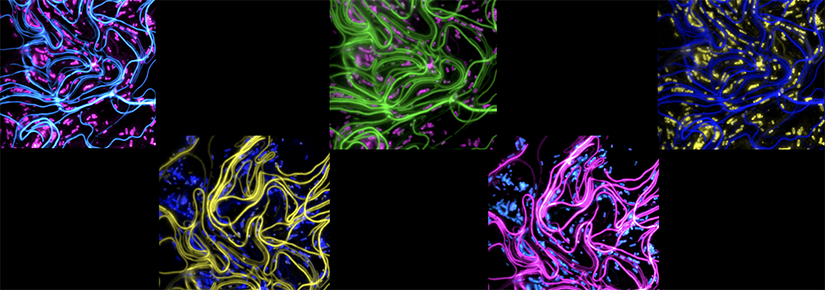 Collage of UPEC filaments and rods after a model Urinary Tract Infection. Pseudocolored for visual effect. 