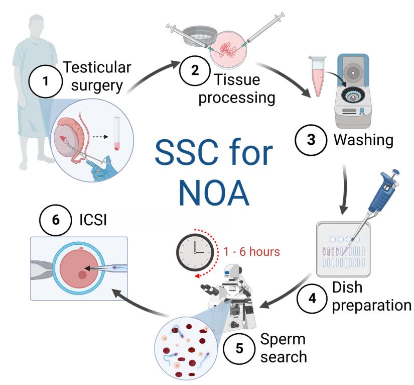 Graphic showing the process of extracting sperm from a tissue sample