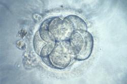 ​'Human embryo from IVF' by K. Hardy. Credit K. Hardy. CC BY