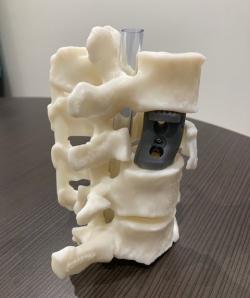 3DMorphic’s vertebrae model